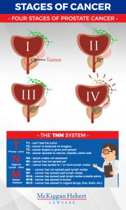 TNM - Stages of Cancer Graphic related to Delayed Cancer Diagnosis